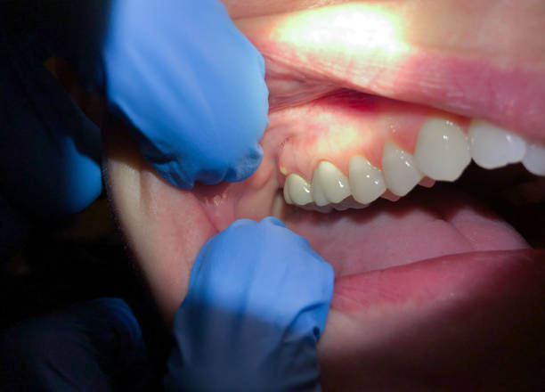 Best Emergency Dentist for Special Needs Patients in Fort Montgomery, NY